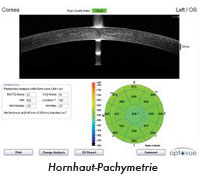 Hornhaut Pachymetrie